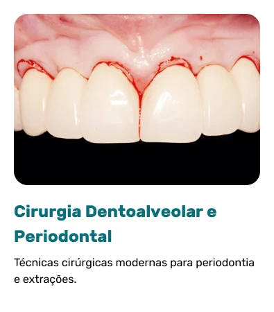 Cirurgia-Dentoalveolar-e-Periodontal.webp