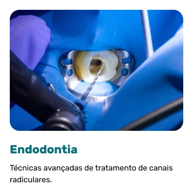 Endodontia.webp